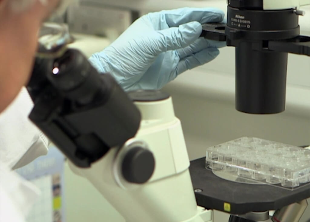 Headcase cancer Trust vision to find a cure for Glioblastoma (GBM)