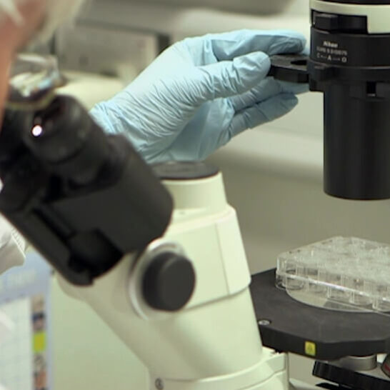 Man looking through a microscope at brain tumour samples